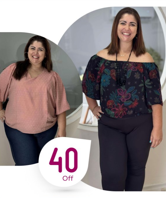 Resultado após o tratamento da paciente Letícia Sardinha